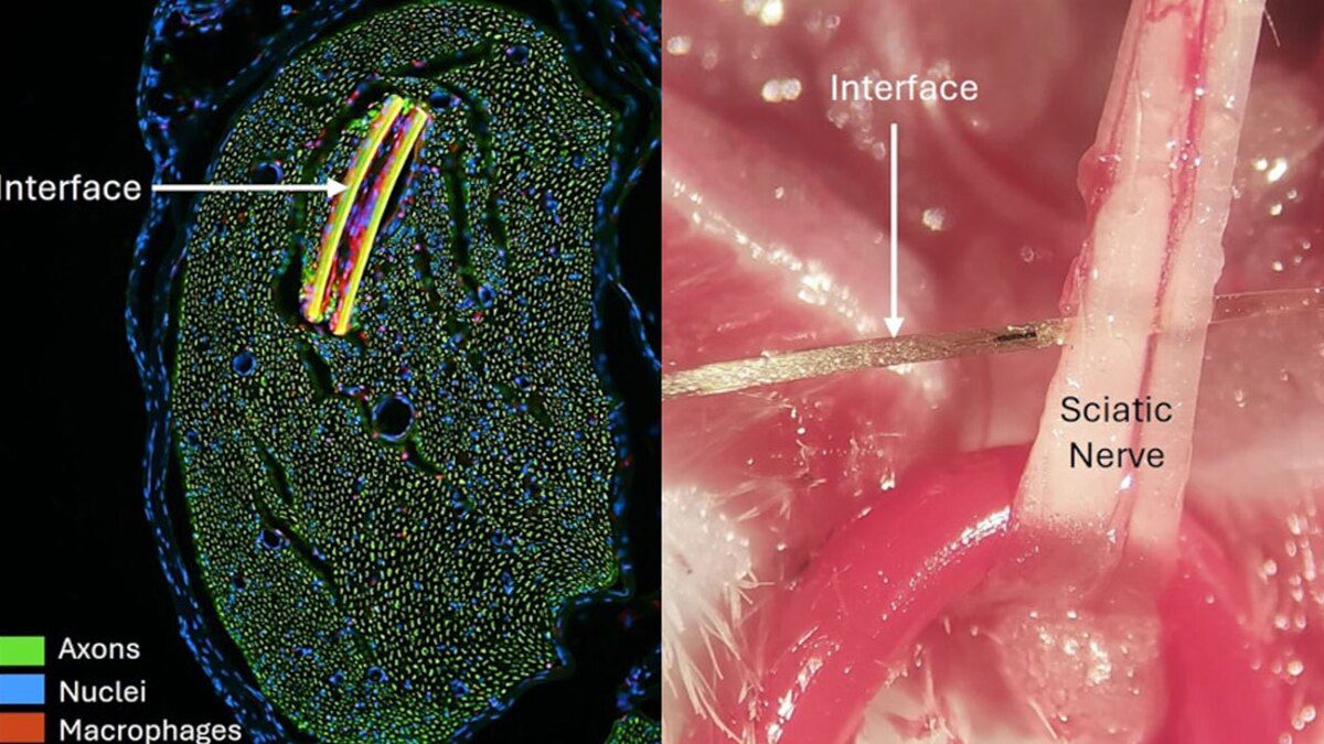 مشتقات گرافن برای تولید رابط مغز و کامپیوتر