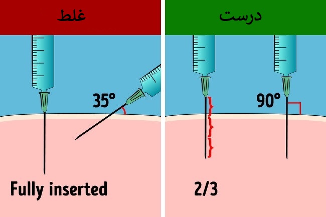 سرنگ و سوزن را ۹۰ درجه به بدن وارد کنید.