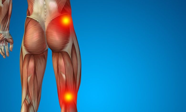 سیاتیک - درمان سیاتیک با چوب کبریت