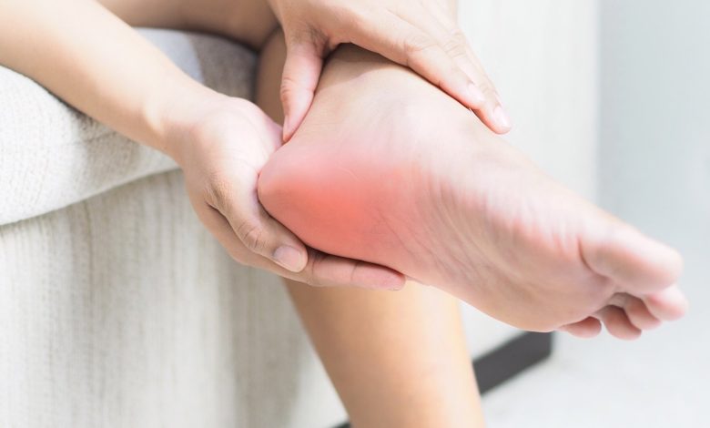 خار پاشنه - درمان خار پاشنه با پودر موبر