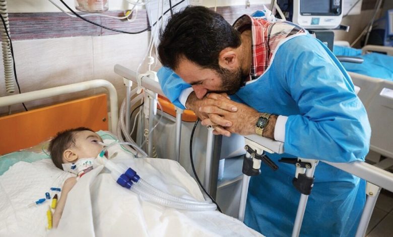 کودک مبتلا به بیماری اس ام ای