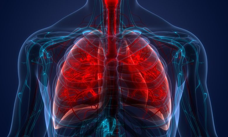 عفونت ریه - پاکسازی ریه از عفونت