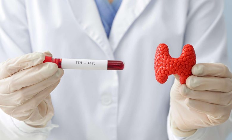 آزمایش تیروئید - روش تست تیروئید در منزل
