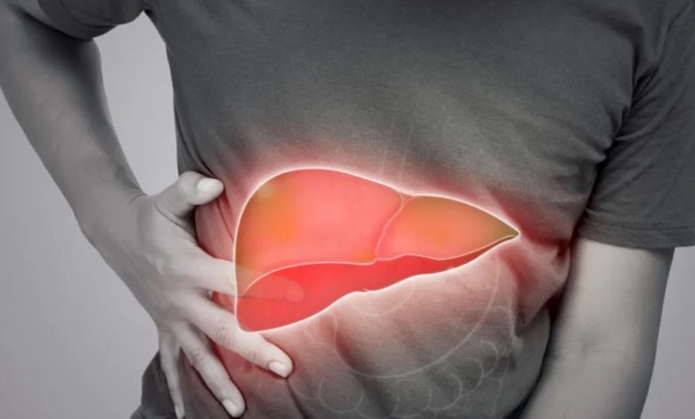 کبد چرب - درمان کبد چرب گرید 2