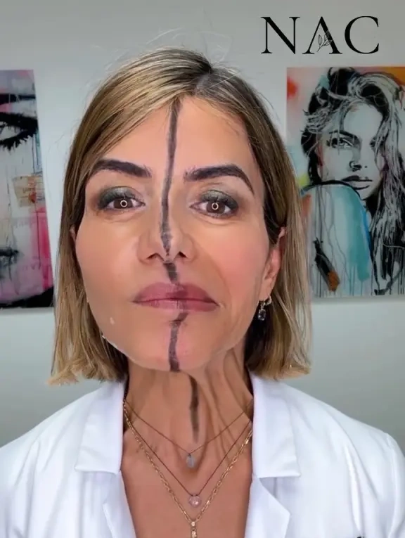 اثر تزریق بوتاکس به یک سمت صورت