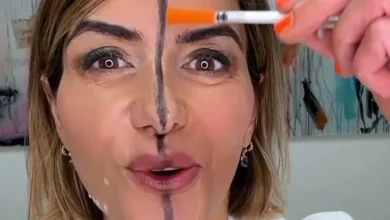 دکتر فارل در حال نشان دادن اثر بوتاکس روی یک سمت صورت