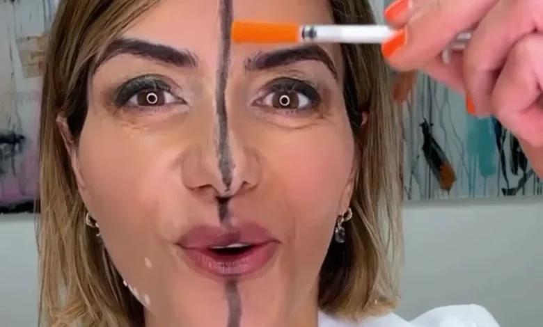 دکتر فارل در حال نشان دادن اثر بوتاکس روی یک سمت صورت