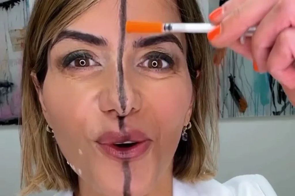 دکتر فارل در حال نشان دادن اثر بوتاکس روی یک سمت صورت