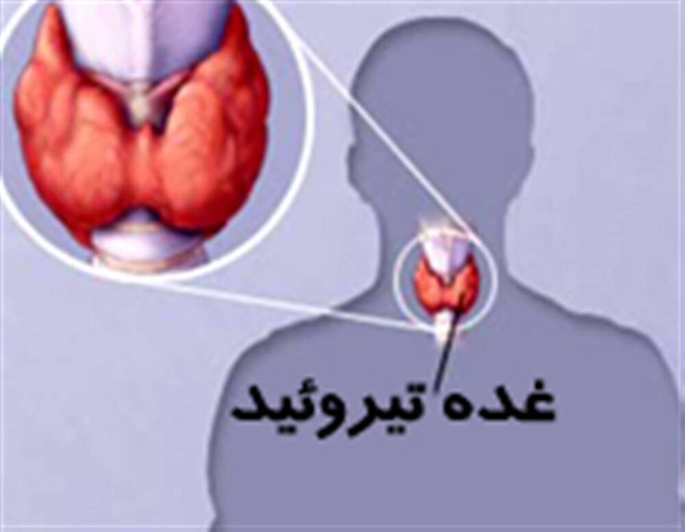 روز جهانی تیروئید؛ انواع بیماری‌های تیروئید + تشخیص و درمان